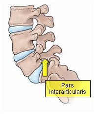 pars interarticularis